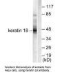 KRT18 Antibody