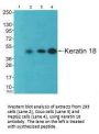 KRT18 Antibody