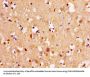 Rabbit anti-human Thiopurine S-methyltransferase polyclonal Antibody