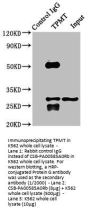 Rabbit anti-human Thiopurine S-methyltransferase polyclonal Antibody