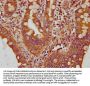 CPNE3 Antibody