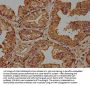 CRH Antibody