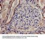 CSDE1 Antibody
