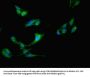 CSDE1 Antibody