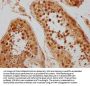 CSE1L Antibody
