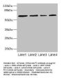 CSGALNACT2 Antibody