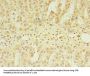 CSGALNACT2 Antibody