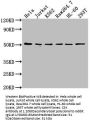 CSK Antibody