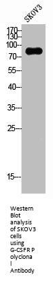 CSF3R Antibody