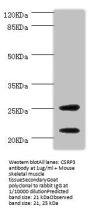 CSRP3 Antibody
