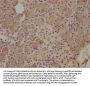 CST5 Antibody