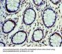 CST7 Antibody