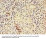 CTPS1 Antibody