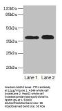 CTSL Antibody