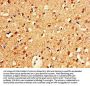 CELF2 Antibody
