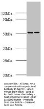 AP2M1 Antibody