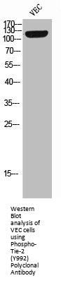Phospho-TEK (Y992) Antibody