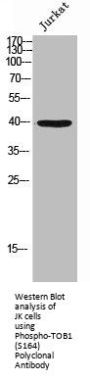 Phospho-TOB1 (S164) Antibody