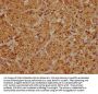 CYP21A2 Antibody