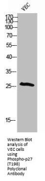 Phospho-CDKN1B (T198) Antibody