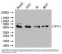 CYP7A1 Antibody