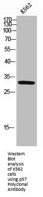 CDKN1C Antibody