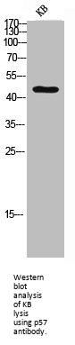 CDKN1C Antibody