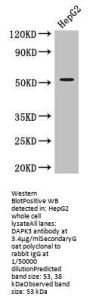 DAPK3 Antibody