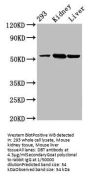 DBT Antibody