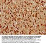 DFFB Antibody