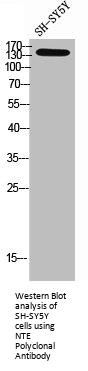 PNPLA6 Antibody