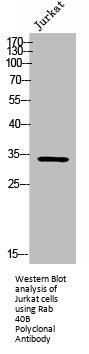 RAB40B Antibody