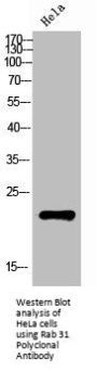 RAB31 Antibody