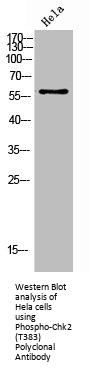 Phospho-CHEK2 (T383) Antibody