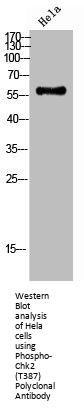 Phospho-CHEK2 (T387) Antibody