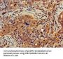 DGAT1 Antibody