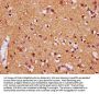 DIRAS1 Antibody