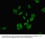 DKC1 Antibody