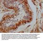 DLG4 Antibody