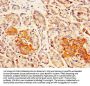 DLK1 Antibody