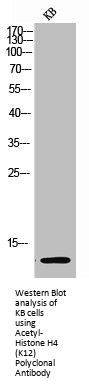 Acetyl-Histone H4 (K12) Antibody