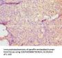 DMP1 Antibody
