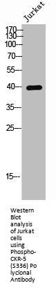 Phospho-CCR5 (S336) Antibody