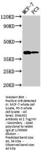 DNASE2 Antibody
