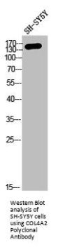 COL4A2 Antibody