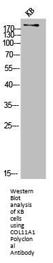 COL11A1 Antibody