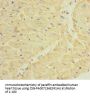 DPT Antibody