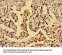 DRD1 Antibody