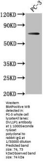 DVL1P1 Antibody