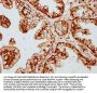 DVL2 Antibody